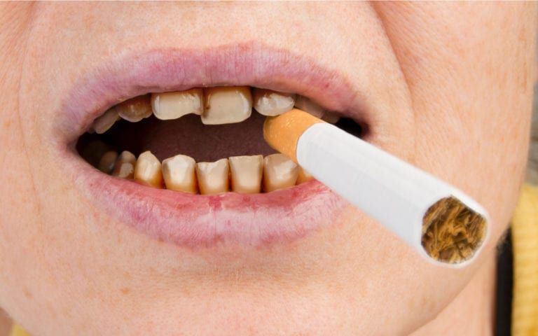 The Impact of Smoking on Oral Health